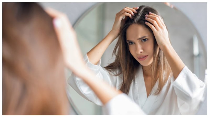 Thinning Hairlines